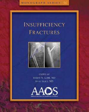 Insufficiency Fractures de Ed. Lane, Joseph M.