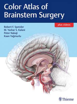 Color Atlas of Brainstem Surgery de Robert F. Spetzler