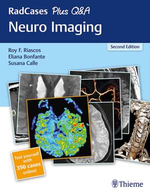 RadCases Plus Q&A Neuro Imaging de Roy F. Riascos–castane