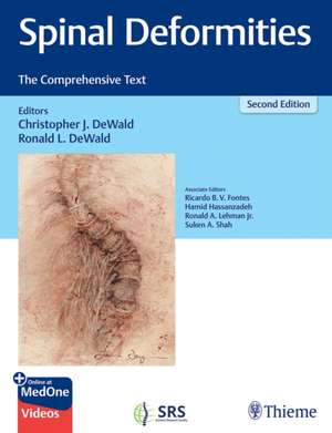 Spinal Deformities – The Comprehensive Text de Ronald L. Dewald