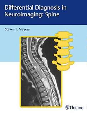 Differential Diagnosis in Neuroimaging: Spine de Steven Meyers