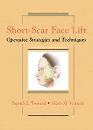 Short–Scar Face Lift – Operative Strategies and Techniques de Patrick Tonnard