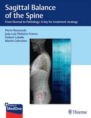 Sagittal Balance of the Spine de P Roussouly