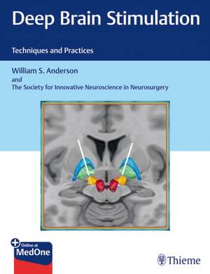 Deep Brain Stimulation – Techniques and Practices de William S. Anderson