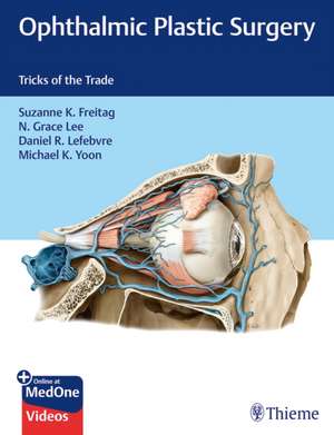 Ophthalmic Plastic Surgery – Tricks of the Trade de Suzanne Freitag