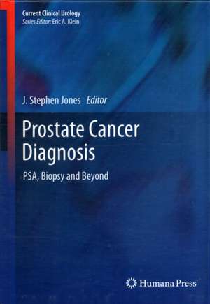 Prostate Cancer Diagnosis: PSA, Biopsy and Beyond de J. Stephen Jones