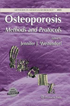 Osteoporosis: Methods and Protocols de Jennifer Westendorf