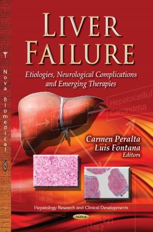 Liver Failure de Carmen Peralta