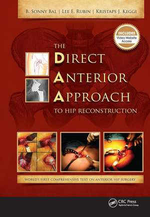 The Direct Anterior Approach to Hip Reconstruction de B. Bal