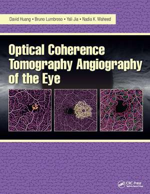 Optical Coherence Tomography Angiography of the Eye: OCT Angiography de David Huang