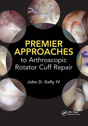 Premier Approaches to Arthroscopic Rotator Cuff Repair de John Kelly