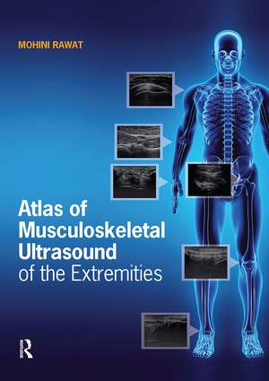 Atlas of Musculoskeletal Ultrasound of the Extremities de Mohini Rawat