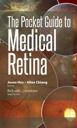 The Pocket Guide to Medical Retina de Jason Hsu