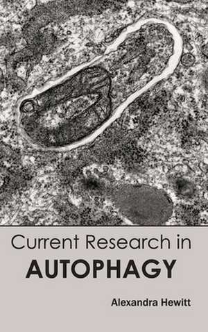 Current Research in Autophagy de Alexandra Hewitt