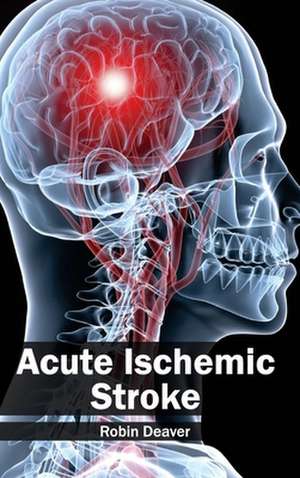 Acute Ischemic Stroke de Robin Deaver