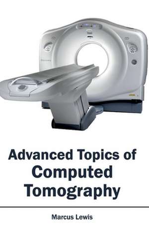 Advanced Topics of Computed Tomography de Marcus Lewis