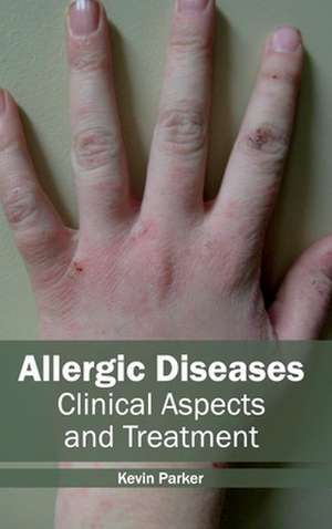 Allergic Diseases de Kevin Parker