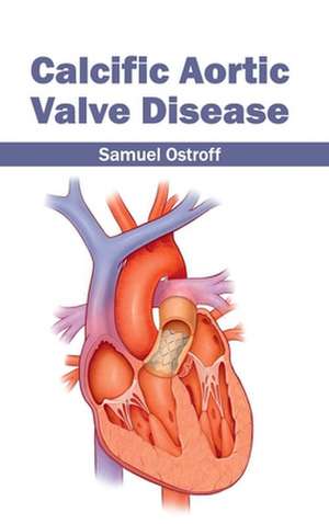 Calcific Aortic Valve Disease de Samuel Ostroff