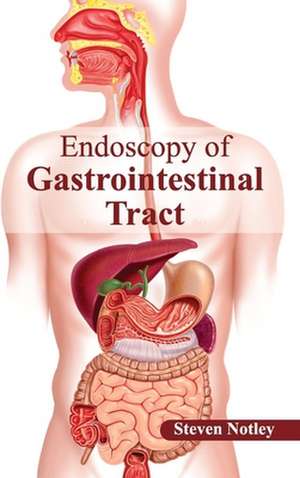 Endoscopy of Gastrointestinal Tract de Steven Notley