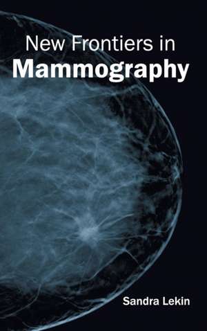 New Frontiers in Mammography de Sandra Lekin