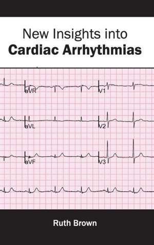 New Insights Into Cardiac Arrhythmias: Clinical and Biological Characteristics de Ruth Brown