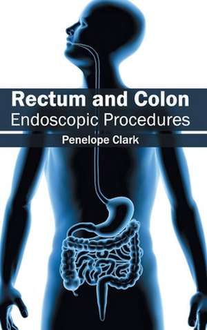 Rectum and Colon de Penelope Clark