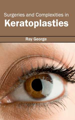 Surgeries and Complexities in Keratoplasties de Ray George