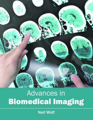 Advances in Biomedical Imaging de Ned Wolf