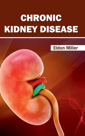 Chronic Kidney Disease de Eldon Miller