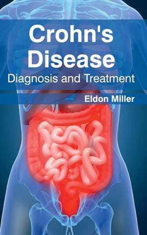 Crohn's Disease de Eldon Miller