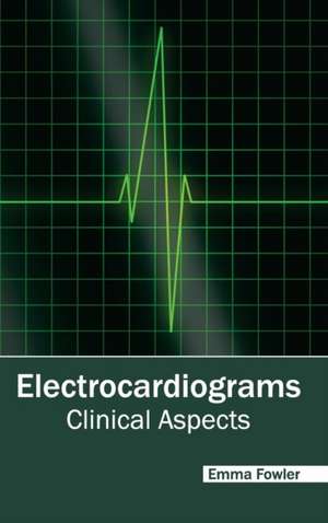 Electrocardiograms de EMMA FOWLER