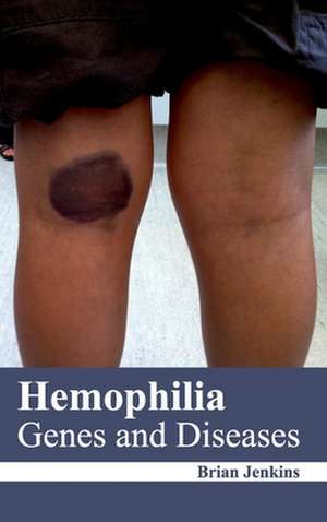 Hemophilia de Brian Jenkins