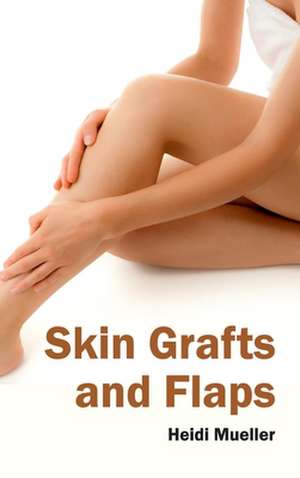 Skin Grafts and Flaps de Heidi Mueller