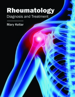 Rheumatology: Diagnosis and Treatment de Mary Kellar