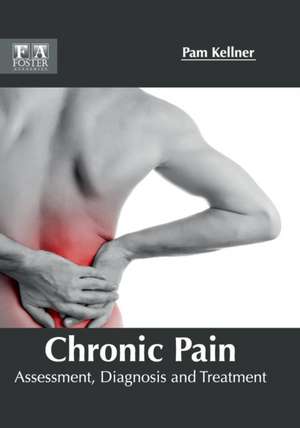 Chronic Pain de Pam Kellner