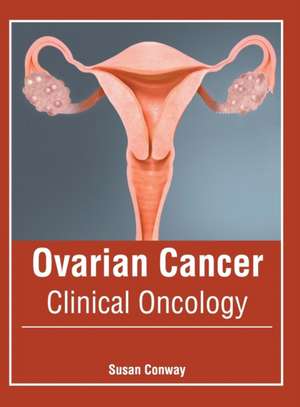 Ovarian Cancer: Clinical Oncology de Susan Conway