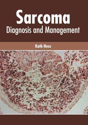 Sarcoma: Diagnosis and Management de Kath Hess