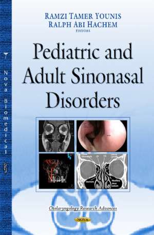 Paranasal Sinuses: Anatomy, Development & Biological Function de Ramzi Tamer Younis