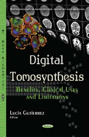 Digital Tomosynthesis: Benefits, Clinical Uses & Limitations de Lucia Gutierrez