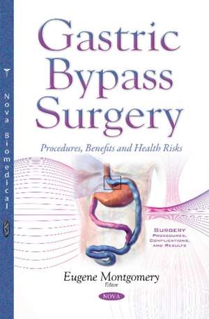 Gastric Bypass Surgery: Procedures, Benefits & Health Risks de Eugene Montgomery