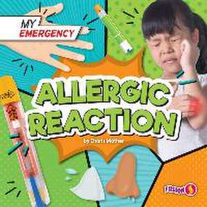 Allergic Reaction de Charis Mather