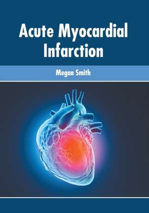 Acute Myocardial Infarction de Megan Smith