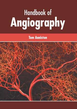 Handbook of Angiography de Tom Anniston