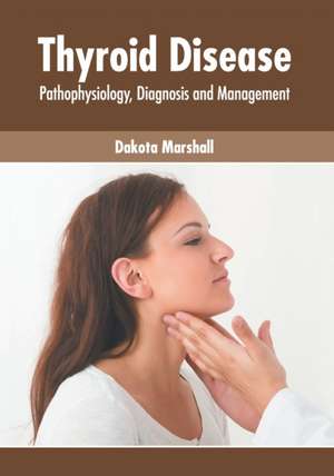 Thyroid Disease: Pathophysiology, Diagnosis and Management de Dakota Marshall