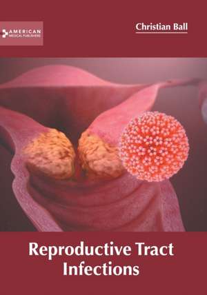 Reproductive Tract Infections de Christian Ball