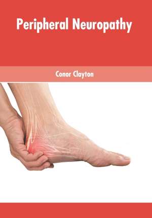 Peripheral Neuropathy de Conor Clayton