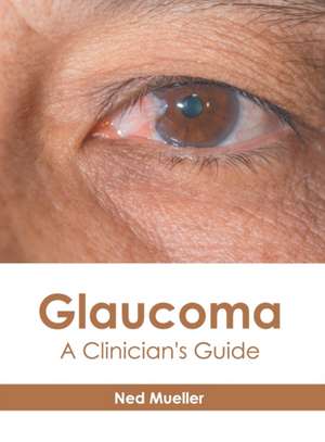 Glaucoma: A Clinician's Guide de Ned Mueller