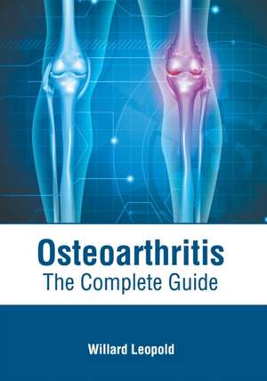 Osteoarthritis: The Complete Guide de Willard Leopold