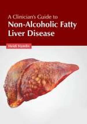 A Clinician's Guide to Non-Alcoholic Fatty Liver Disease de Heidi Hamlin