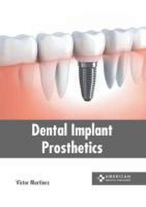 Dental Implant Prosthetics de Victor Martinez